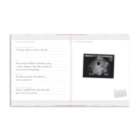 Pearhead Chevron Babybook Первый альбом малыша Pink P62202